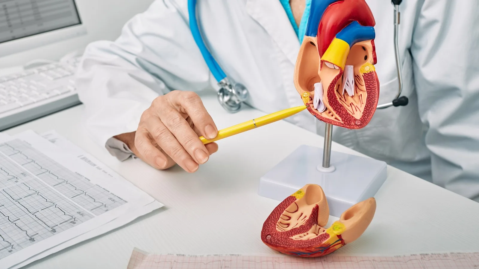Abordaje Médico de la Angina Crónica en CDMX