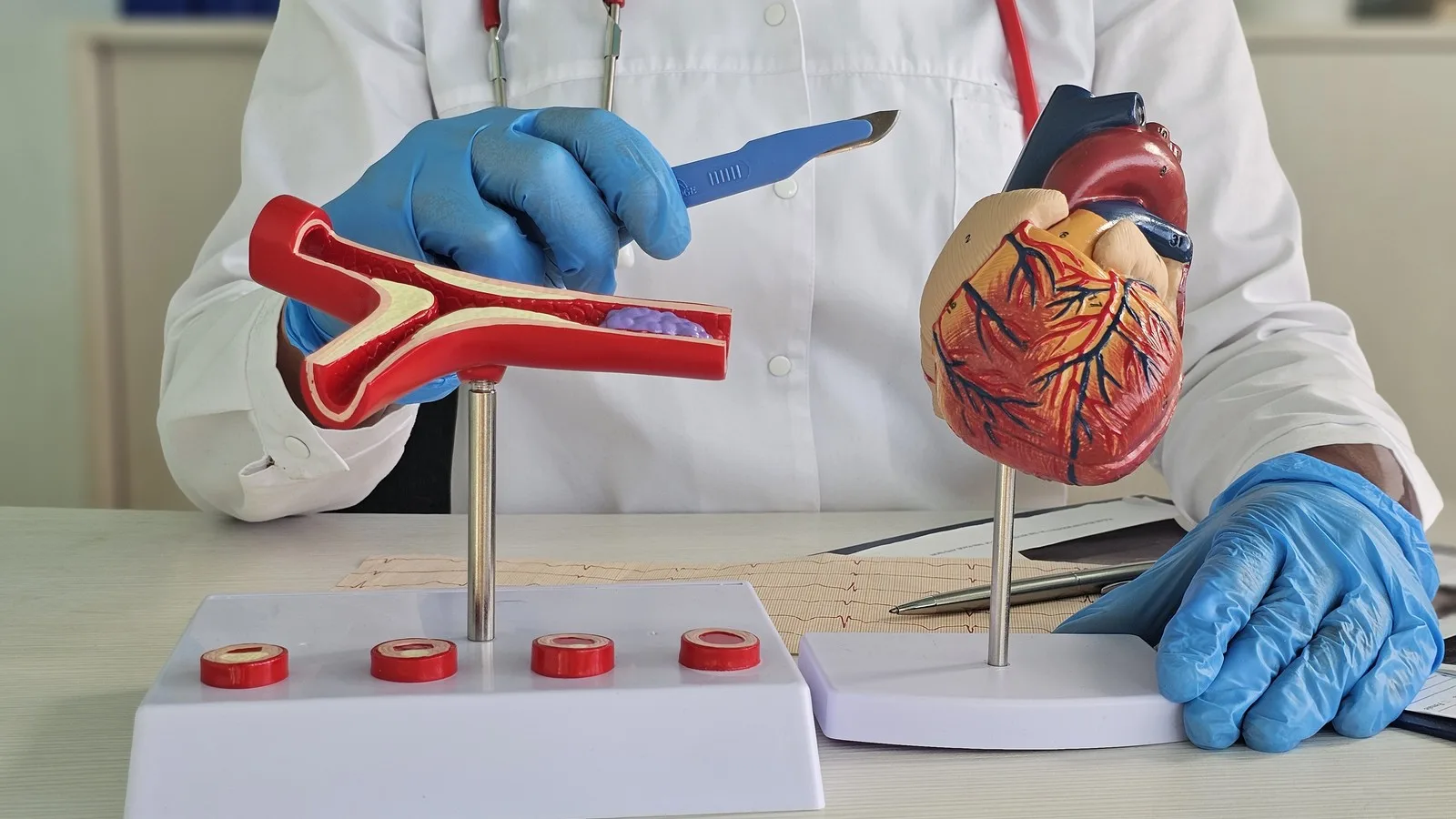 Cardiólogo intervencionista biblioteca vasconcelos: Alta especialidad cardiovascular en Buenavista, CDMX