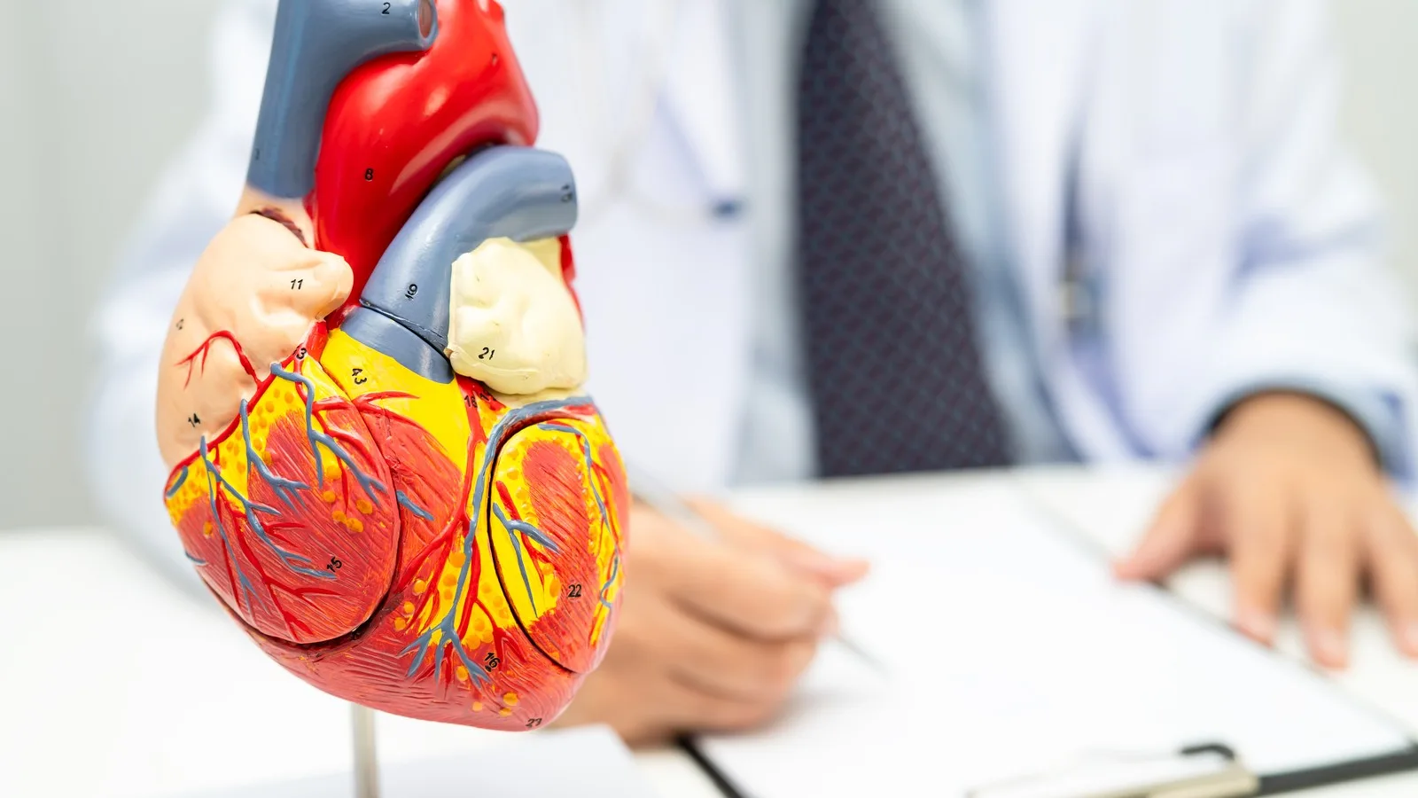 ¿En qué consiste el cateterismo cardíaco diagnóstico en CDMX?