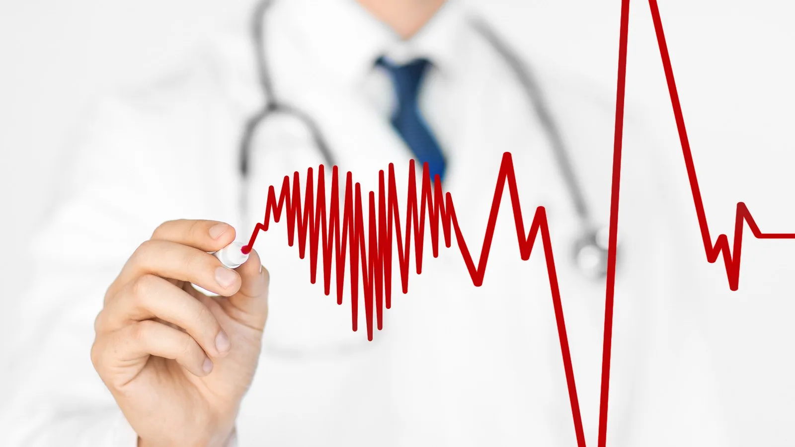 Consulta para colocación de stents coronarios