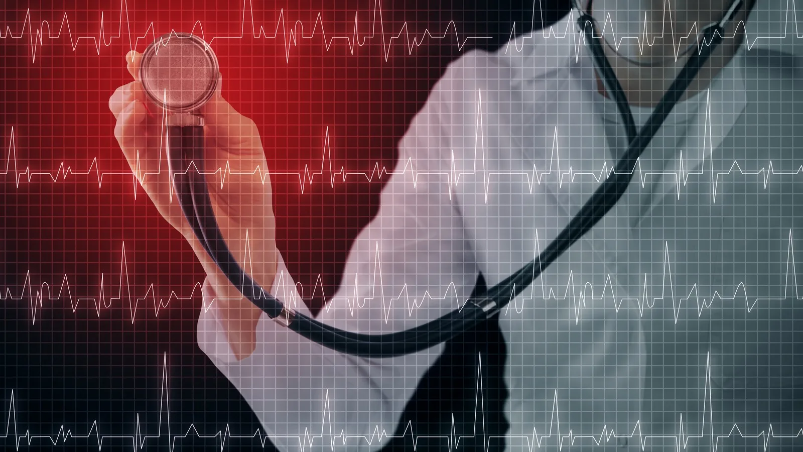 Evaluación de complicaciones después de infarto en CDMX
