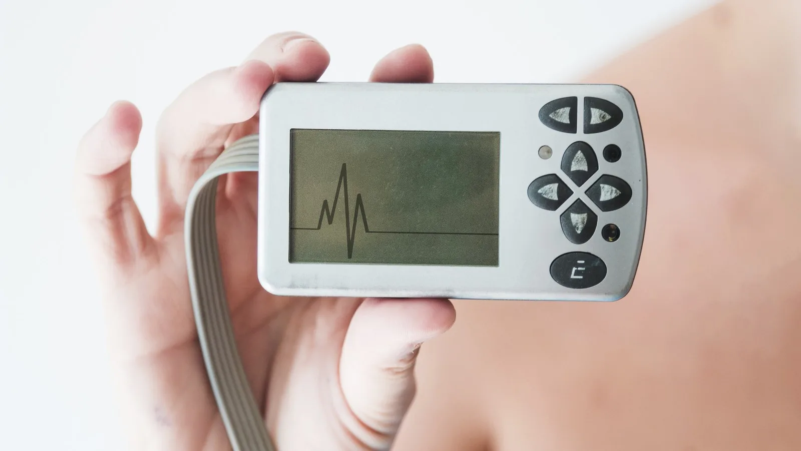 Estudio Holter cerca de CDMX: atención cardiológica
