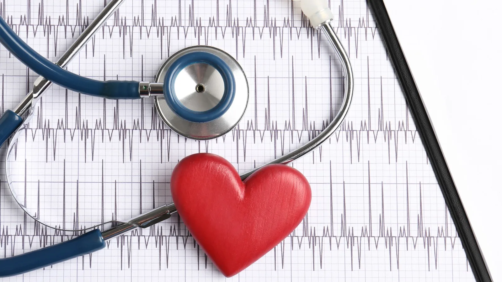 Precio de electrocardiograma en CDMX